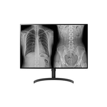 LG MONITOR DIAGNOSTICO IPS 32" (31.5) 8MP UHD 4K HDMI DP HAS PIVOT 32HL512D